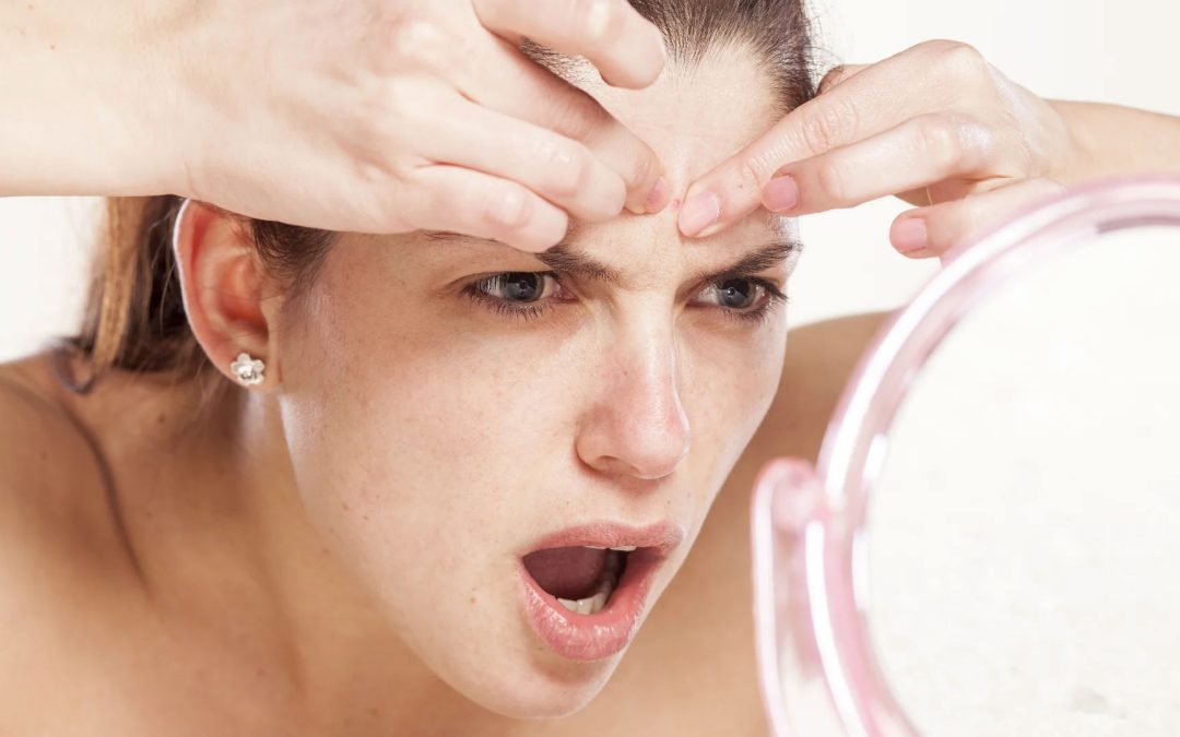 Beware of Breakouts – Skincare Ingredients that Cause Acne
